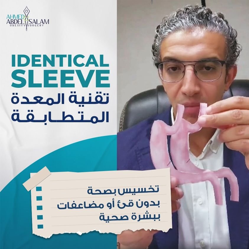 المعدة المتطابقة Identical Sleeve