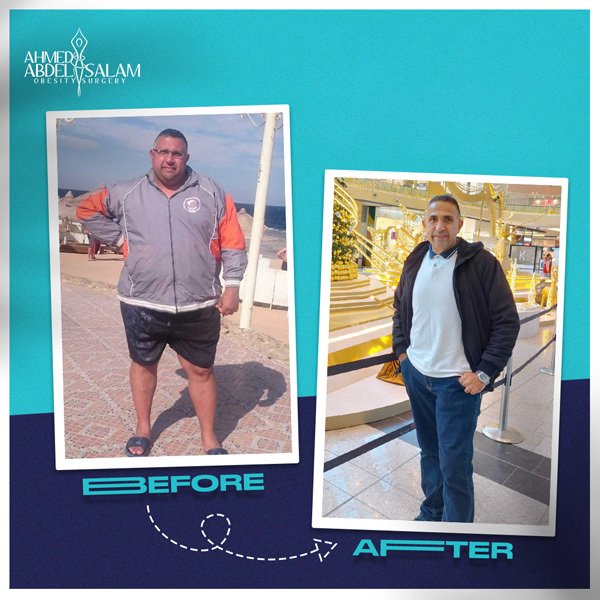 Get Rid of Obesity and Enjoy a Healthier Life