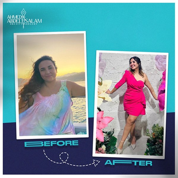 Enjoy Healthy Weight Loss After Gastric Sleeve
